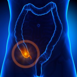 Acute appendicitis, symptoms of appendicitis