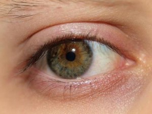 What causes dry eyes?